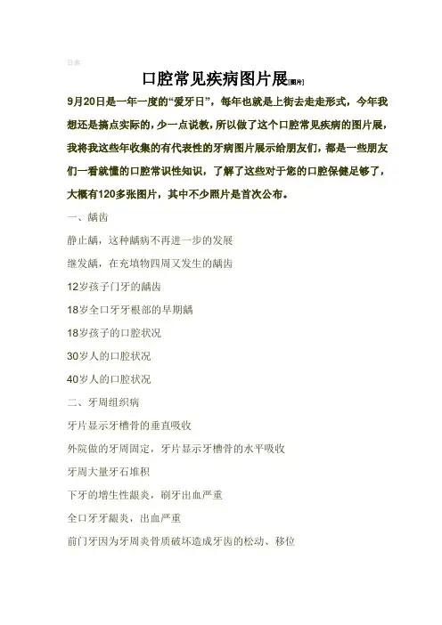 口腔常见疾病图片展