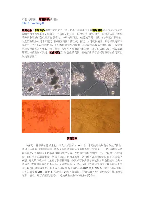 细胞的细菌、真菌污染及排除