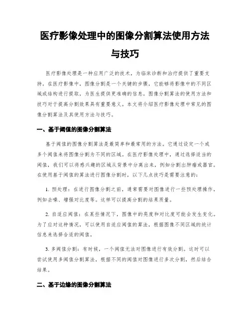 医疗影像处理中的图像分割算法使用方法与技巧