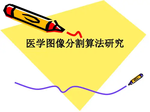 医学图像分割算法研究_ppt课件