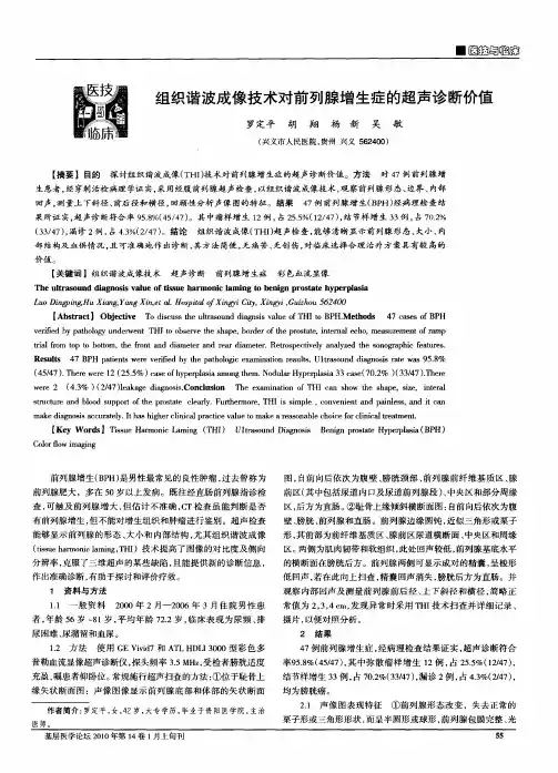 组织谐波成像技术对前列腺增生症的超声诊断价值