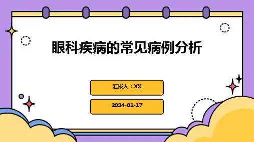 眼科疾病的常见病例分析