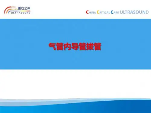 气管内导管拔管