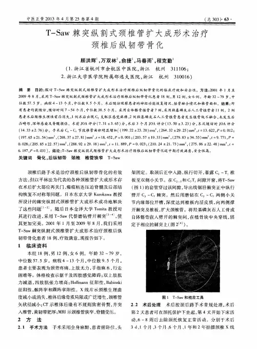 T—Saw棘突纵割式颈椎管扩大成形术治疗颈椎后纵韧带骨化