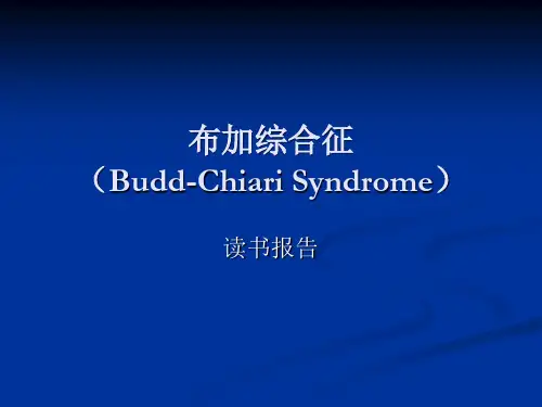 布加综合征