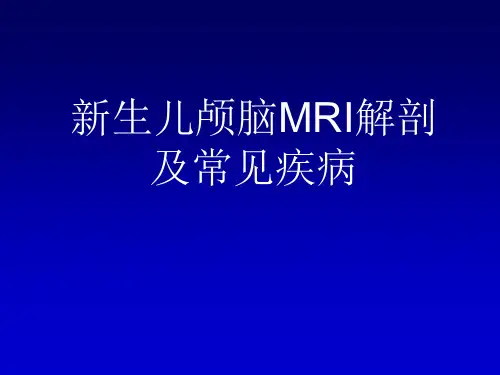 新生儿颅脑MRI解剖及常见疾病