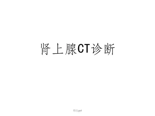 《肾上腺CT诊断》
