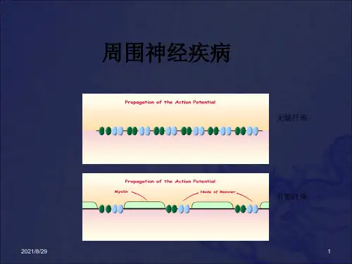 《格林巴利综合征》PPT课件_OK
