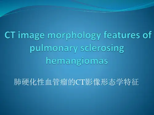 肺硬化性血管瘤影像表现