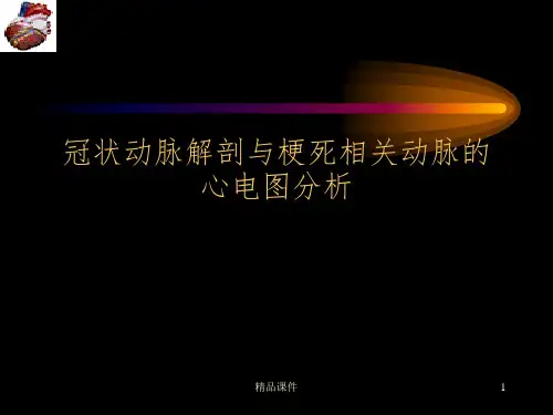 冠脉解剖与梗死相关血管心电图分析PPT课件