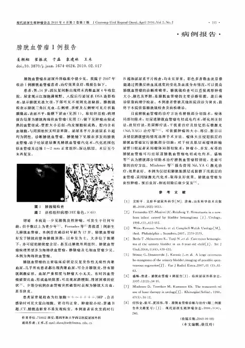 膀胱血管瘤1例报告
