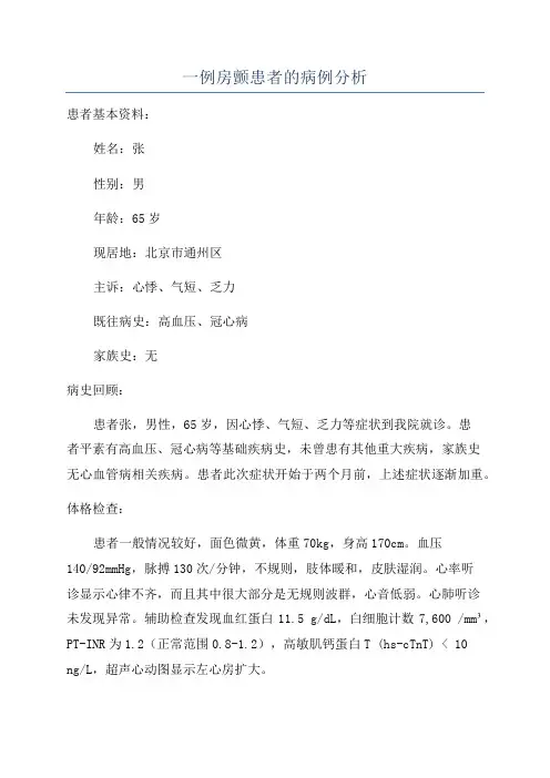 一例房颤患者的病例分析