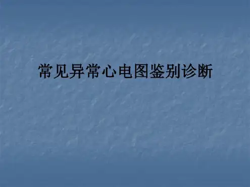 常见异常心电图鉴别诊断_2022年学习资料