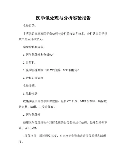 医学像处理与分析实验报告