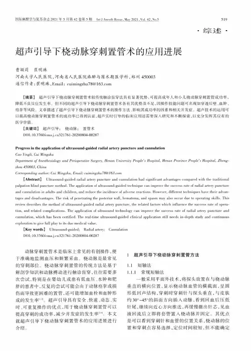 超声引导下桡动脉穿刺置管术的应用进展