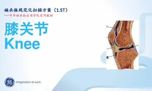 膝关节MRI规范化扫描方案