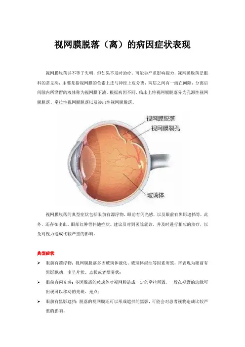 视网膜脱落(离)的病因症状表现