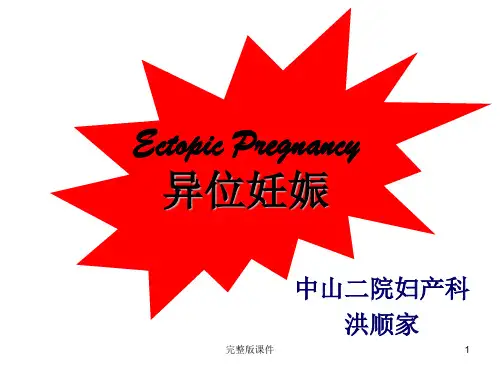 异位妊娠完整ppt课件