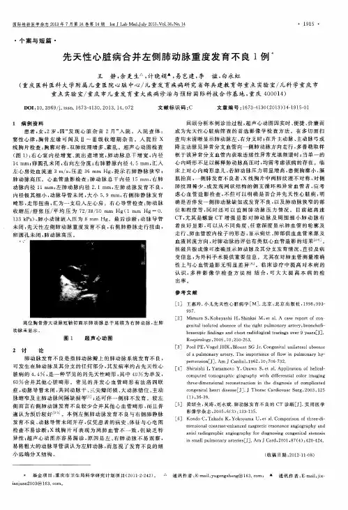 先天性心脏病合并左侧肺动脉重度发育不良1例