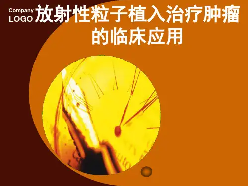 放射性粒子植入治疗培训ppt