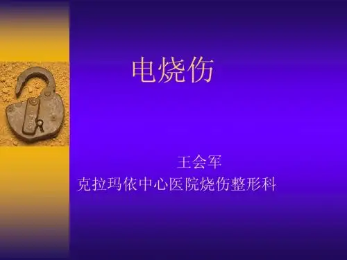 电烧伤