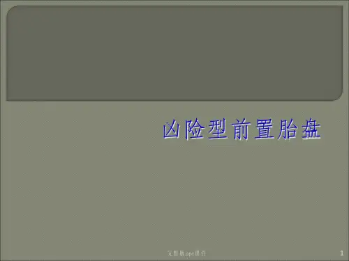 凶险性前置胎盘的诊治ppt课件