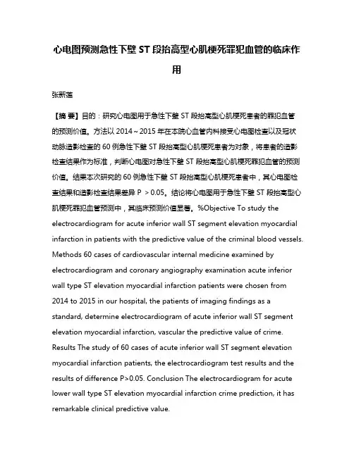 心电图预测急性下壁ST段抬高型心肌梗死罪犯血管的临床作用