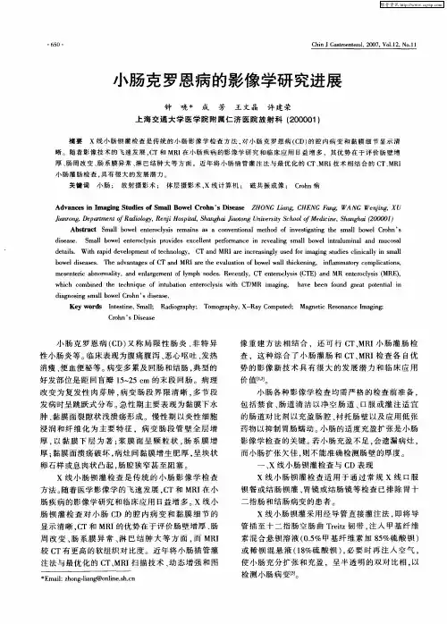 小肠克罗恩病的影像学研究进展
