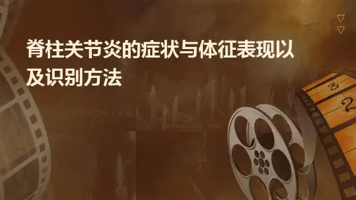 脊柱关节炎的症状与体征表现以及识别方法课件