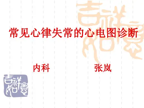 常见心电图诊断