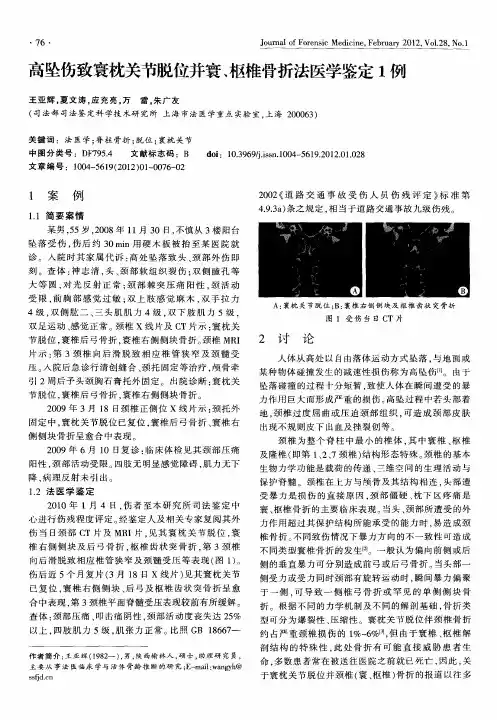 高坠伤致寰枕关节脱位并寰、枢椎骨折法医学鉴定1例