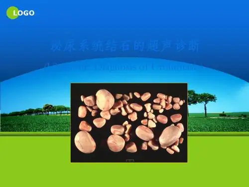 最新泌尿系结石的超声诊断-药学医学精品资料