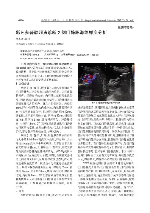 彩色多普勒超声诊断2例门静脉海绵样变分析