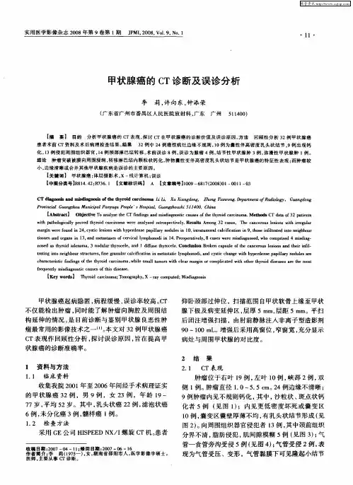 甲状腺癌的CT诊断及误诊分析