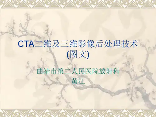 (完整)CT常用图像后处理精品PPT资料精品PPT资料
