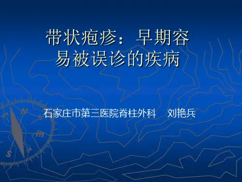 带状疱疹