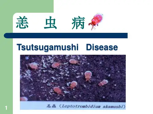 恙虫病PPT