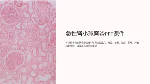 急性肾小球肾炎PPT课件