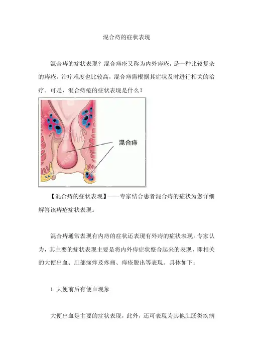 混合痔的症状表现