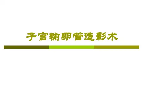 子宫输卵管造影术 -优秀医学PPT课件