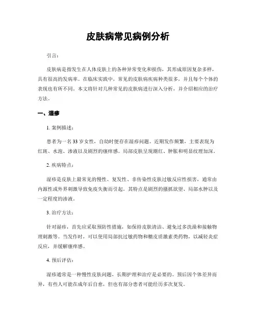 皮肤病常见病例分析