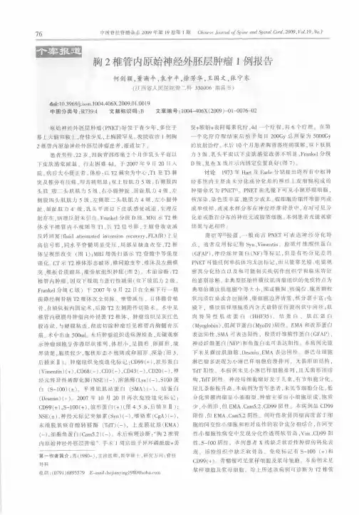 胸2椎管内原始神经外胚层肿瘤1例报告