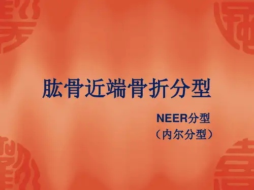 骨折常用分型课件