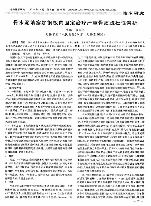 骨水泥填塞加钢板内固定治疗严重骨质疏松性骨折