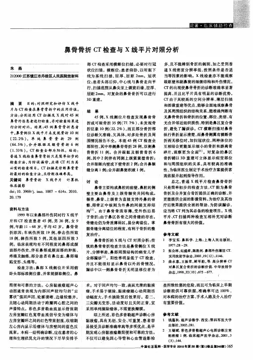 鼻骨骨折CT检查与X线平片对照分析