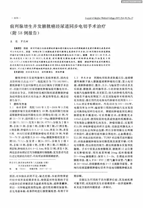 前列腺增生并发膀胱癌经尿道同步电切手术治疗(附58例报告)