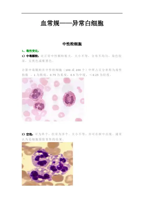 血常规—异常白细胞