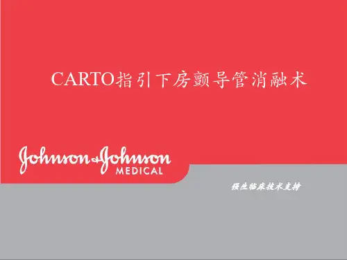 CARTO 房颤消融