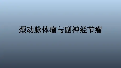 副神经节瘤影像