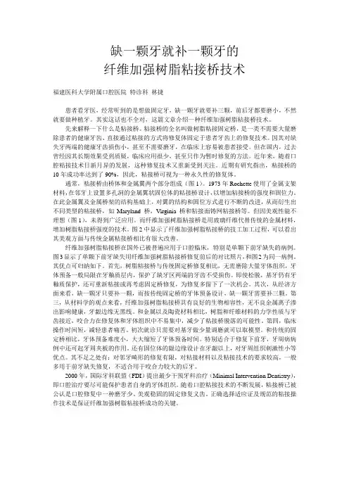 缺一颗牙就补一颗牙的纤维加强树脂粘接桥